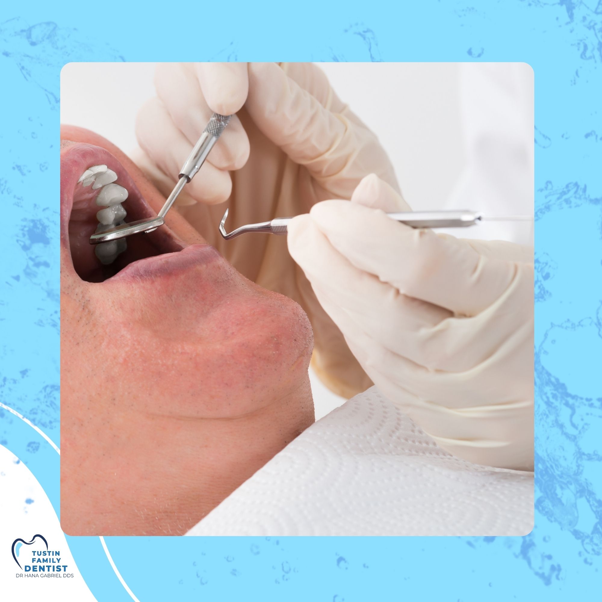 Illustrated fluoride droplet and shield protecting a tooth