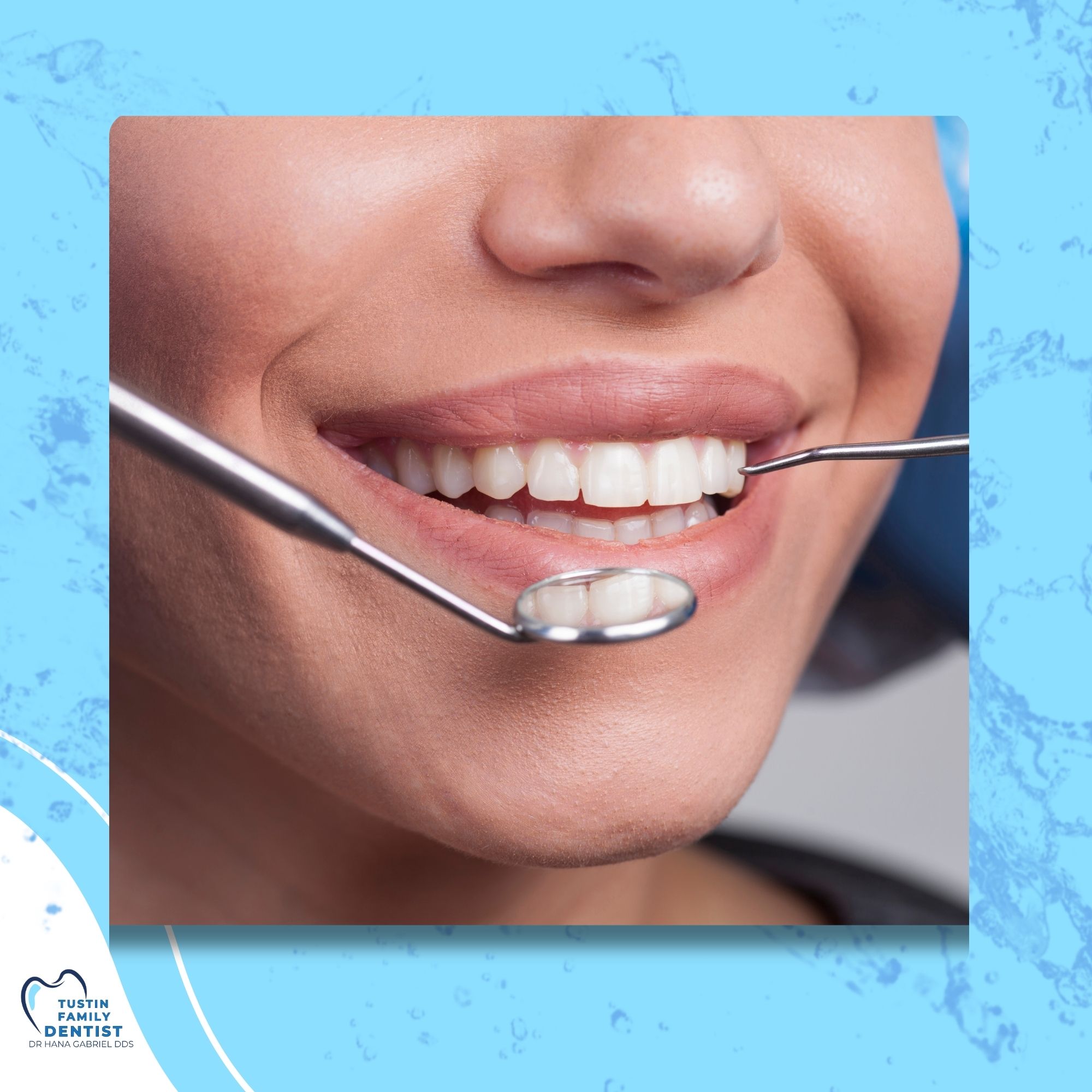 Illustrated clipboard and tooth graphics representing routine dental exams