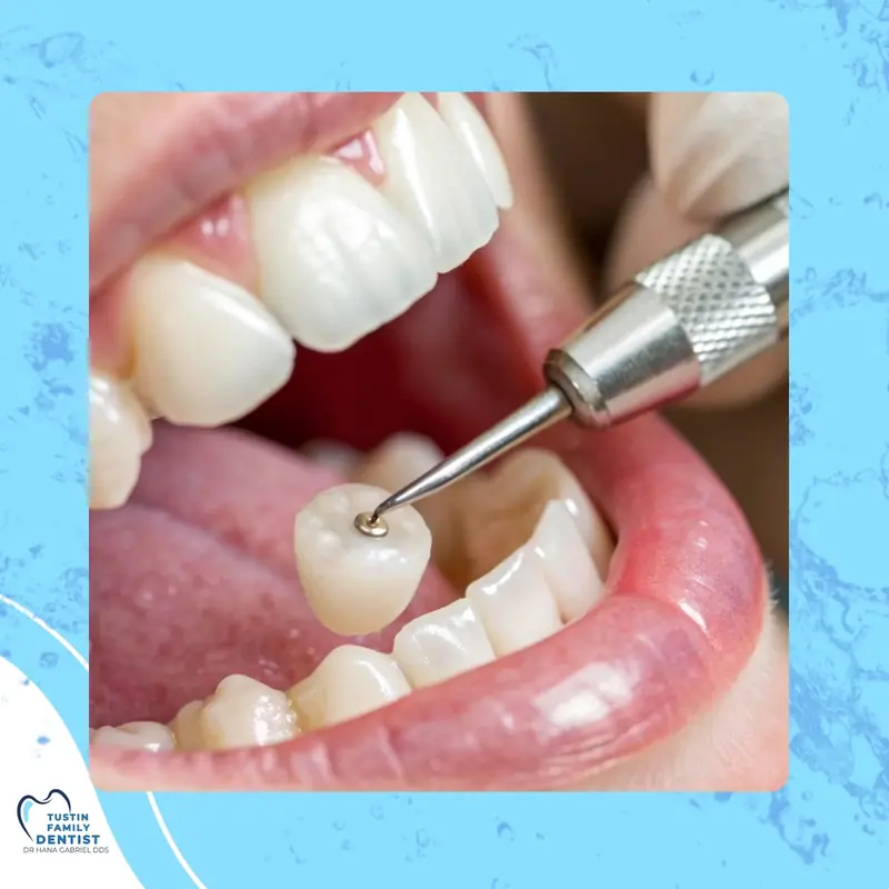 Illustrated crown imagery highlighting crowns, bridges, and dentures