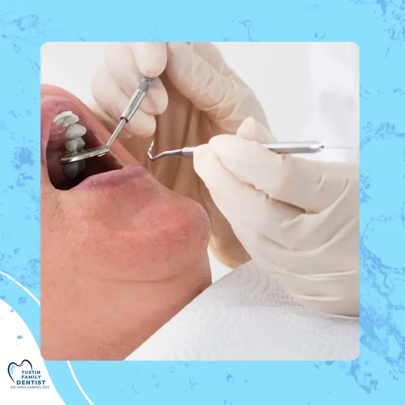 Illustrated fluoride droplet and shield protecting a tooth